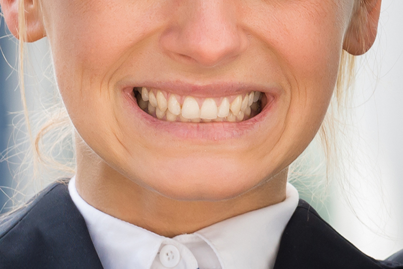 woman grinding teeth bruxism